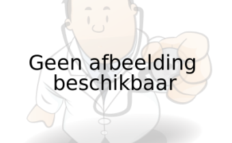 Plexiglas baklijst. Maatvoering zijn de BUITENMATEN van de baklijst!