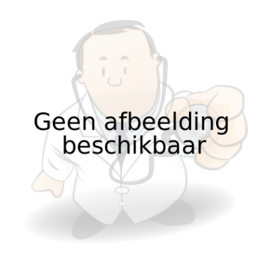 Plexiglas stofkap volledig op maat gemaakt